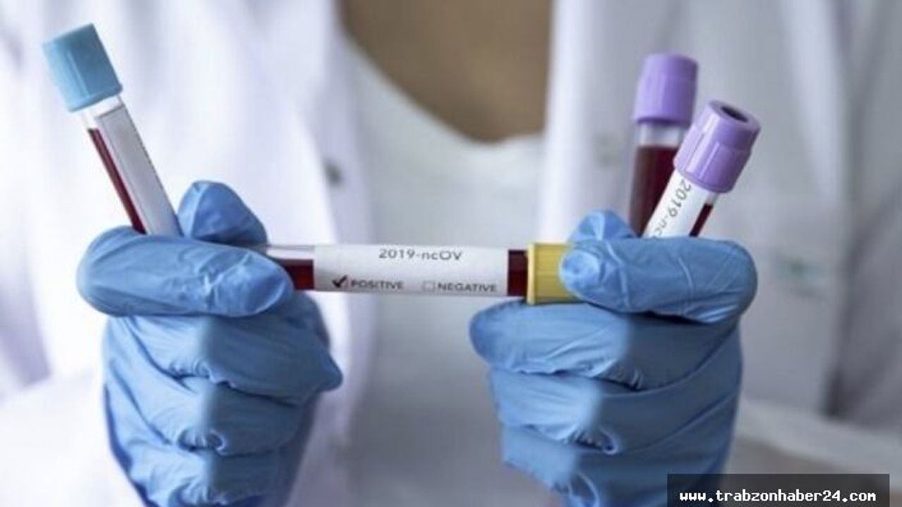 Bugün Koronavirüsten 254 Kişi Öldü